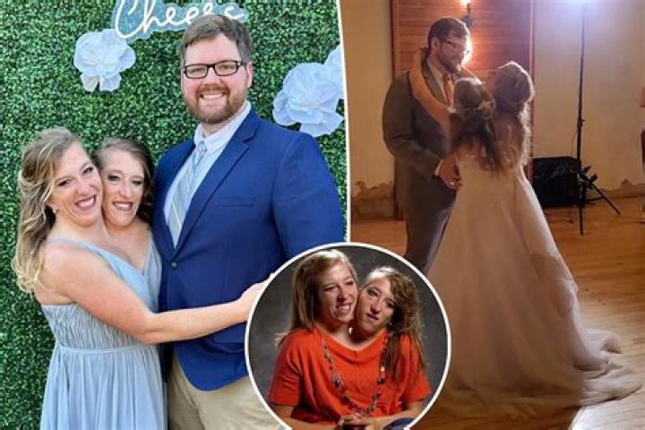 Abby and Brittany Hensel Bio, Are They Married or Engaged? Here Are Facts