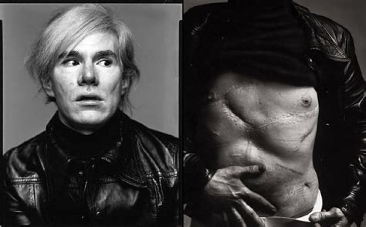 Andy Warhol Cause Of Death