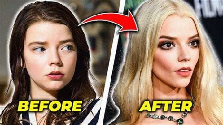 Anya Taylor-Joy’s Height, Weight, Measurements and Plastic Surgery
