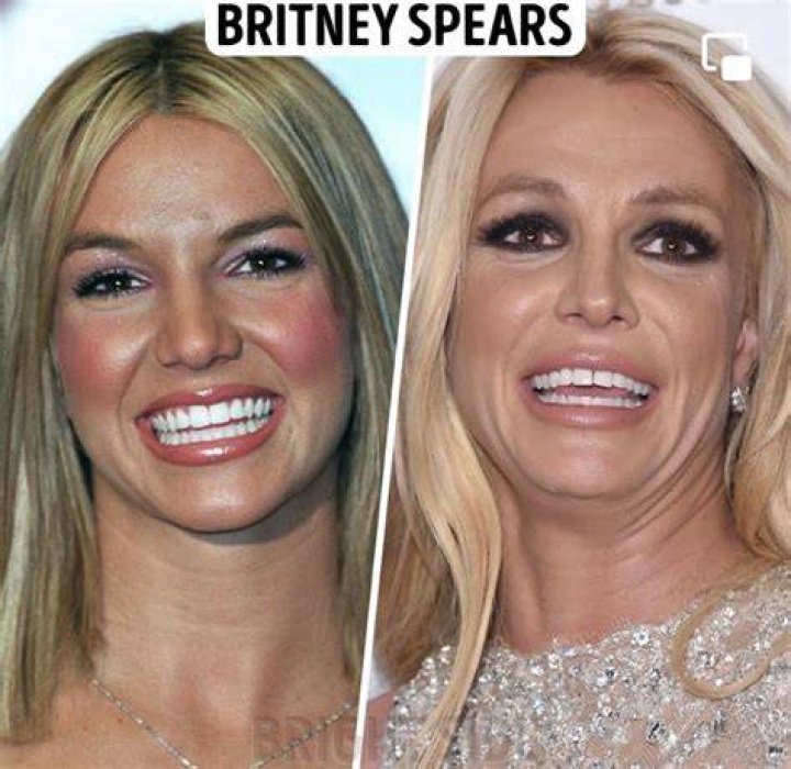 Britney Haynes Plastic Surgery 2023 | Before And After Photos