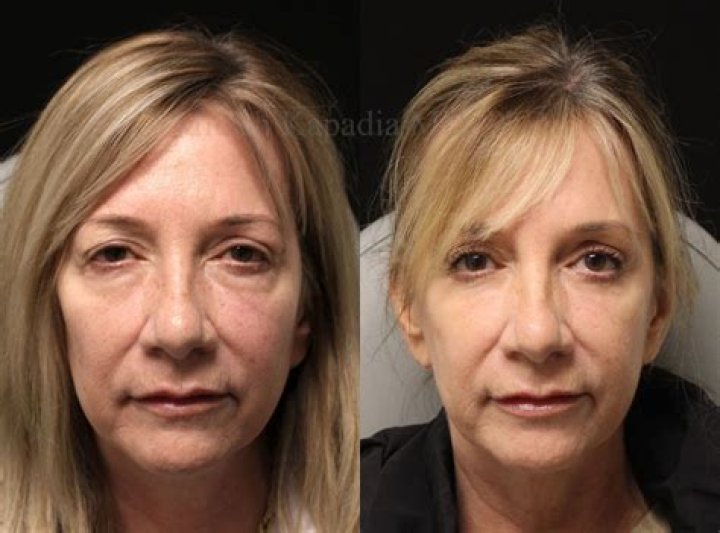 Daphne Dorman Before Surgery Pictures On Instagram, Here Is How Comedian Looked