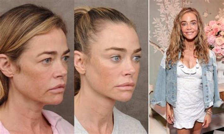 Denise Richards Before Plastic Surgery! Who Is Denise Richards? Denise Richards Wikipedia, Age, Height, Husband, And Net Worth