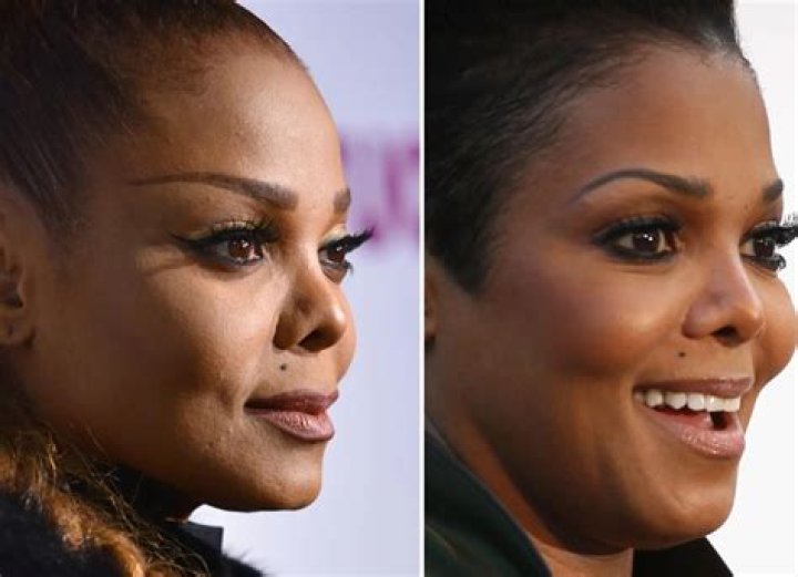 Did Vanessa Amorosi Do A Nose Job? Plastic Surgery Rumors Of The Australian Singer