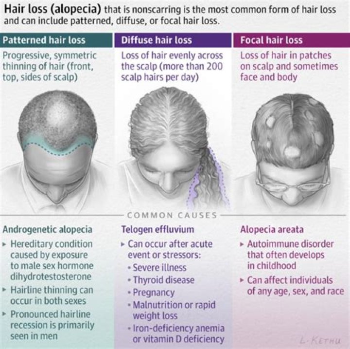 Does Heather Land Have Cancer? Her Shaved Head And Hair Loss Reason