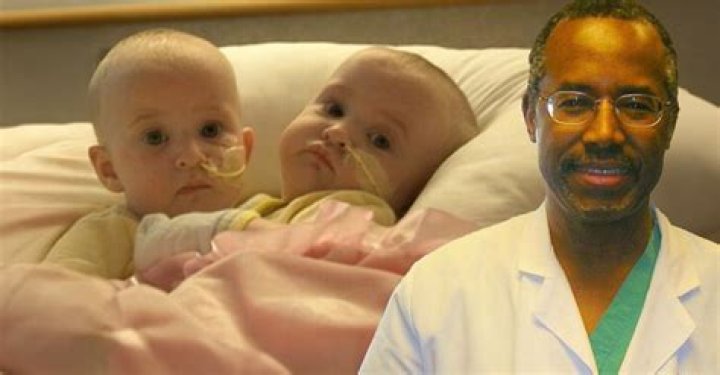 Dr. Ben Carson Biography, Age, Movie, Net Worth, Wife, Quotes, Mother, Conjoined Twins