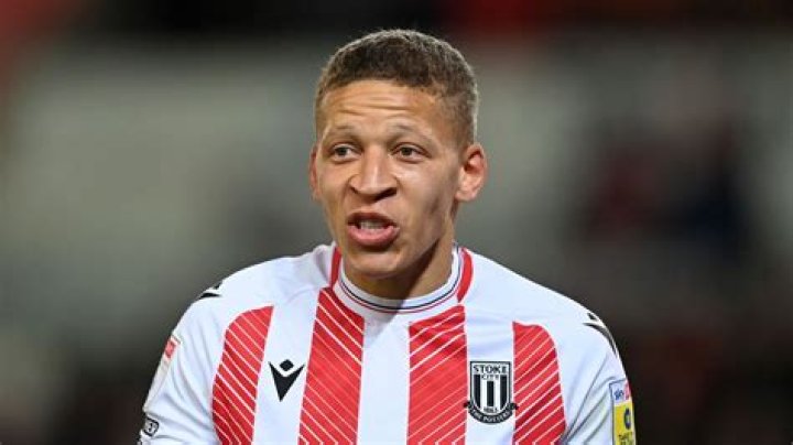 Dwight Gayle