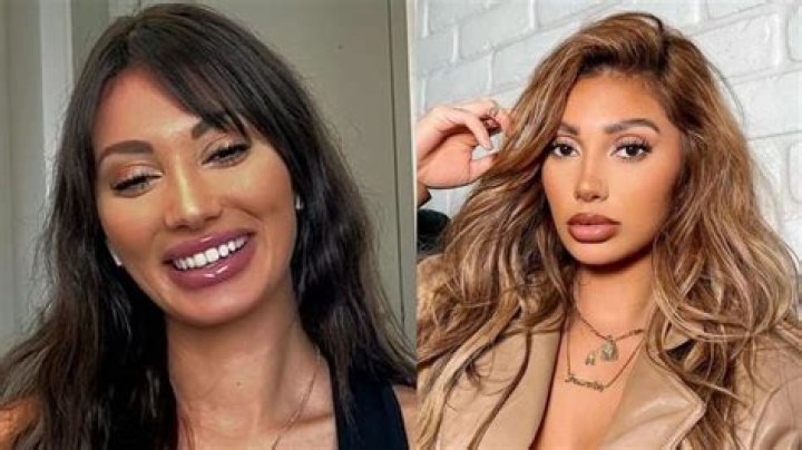 Francesca Farago Before Plastic Surgery: Did The Reality Star Have Lip Fillers, Nose Job, and a Boob Job?