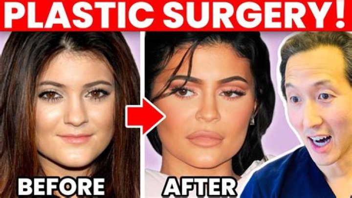 Jewel Staite Plastic Surgery Before And After; What Happened To Quantum Leap Cast? Health Update