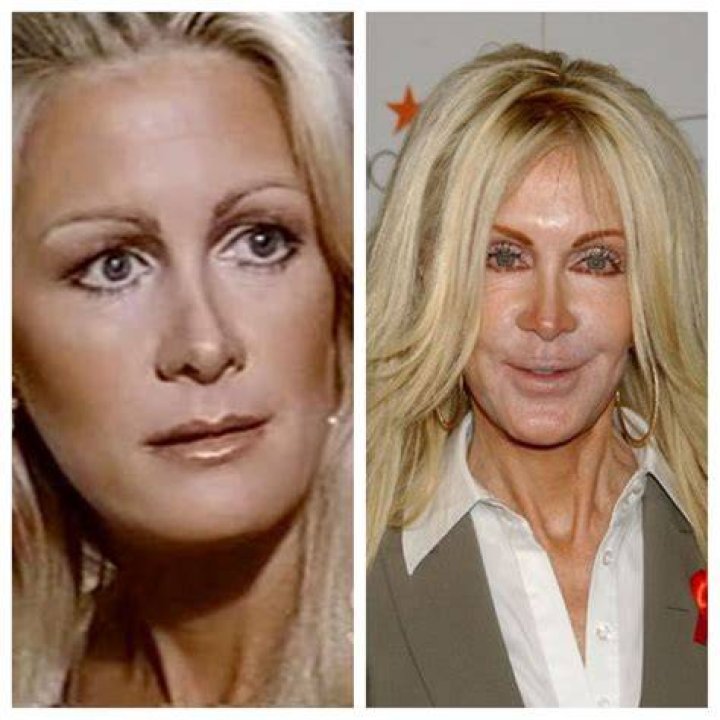 Joan Van Ark Bio , Age, Height, Family, Husband, Movies, Plastic Surgery and Net Worth