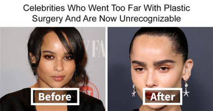Maria Arreghini Chirurgia Estetica | Plastic Surgery Before And After Photos