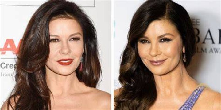 Mikaela Testa Debates Plastic Surgery Claims Back And Forth
