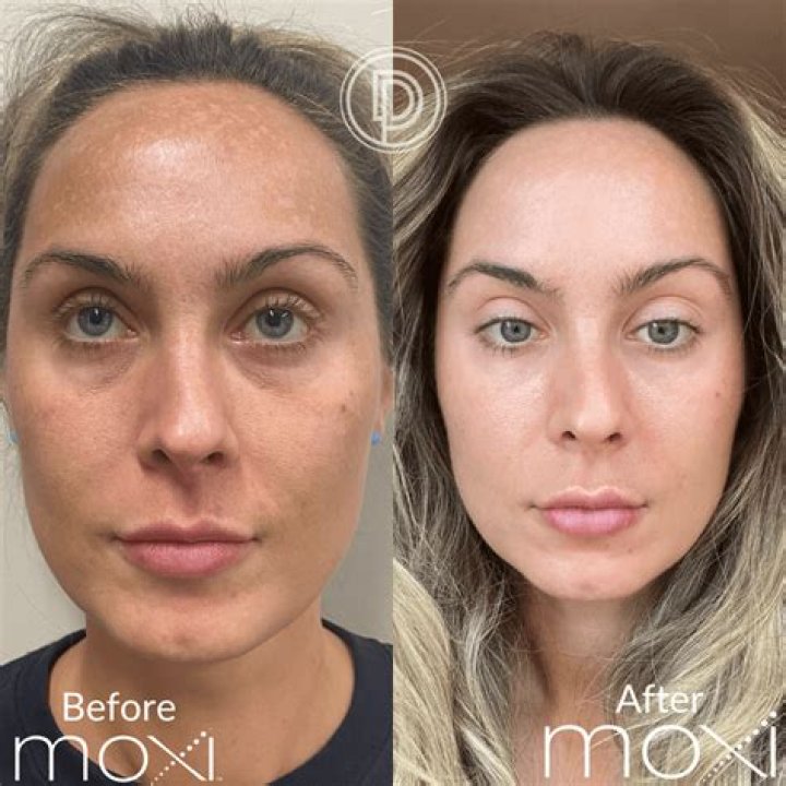 Moxy Face and Age Revealed: Birthday, Wiki, Biography, Instagram