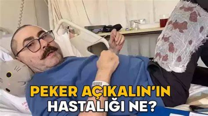 Peker Açıkalın