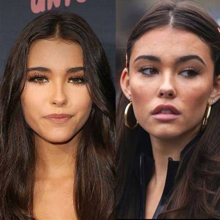 Queen Manica Money Before Surgery | Plastic Surgery Before And After Photos