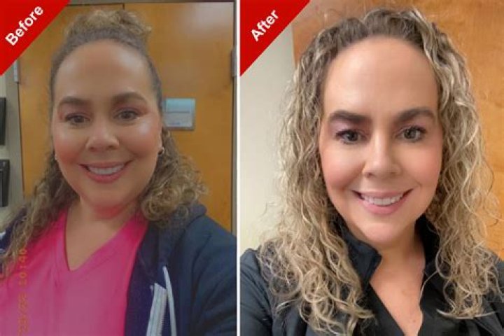 Remi Bader’s Weight Loss: The Use of Ozempic Drug and its Consequences; Check Out the TikToker’s Before and After Pictures!