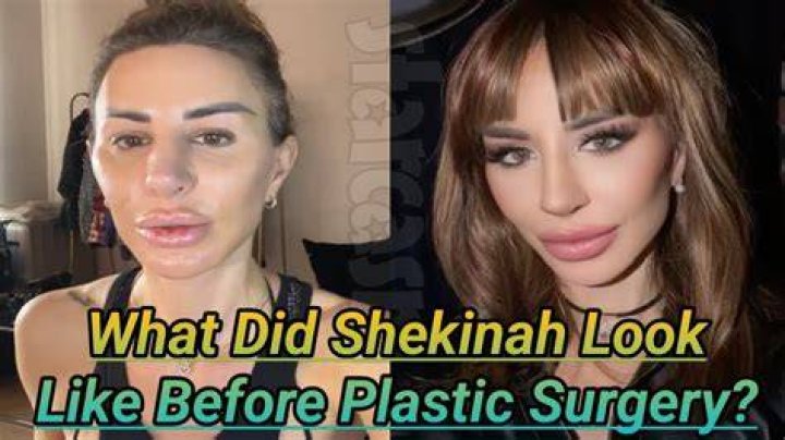 Shekinah 90 Day Fiance Before Surgery | Plastic Surgery Transformation
