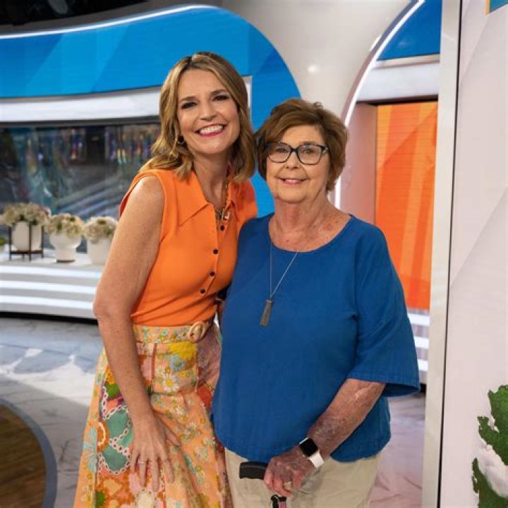 What Is The Reason Behind Savannah Guthrie Weight Loss? – Did She Get A Surgery?