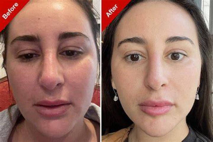 What We Know About Elliotte Friedman Hair and Weight Loss