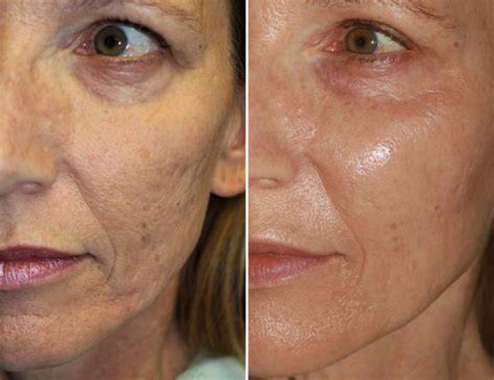 Whats Wrong With MakeupArtistGorda66 aka Marimar Quiroa Face? Before & After Story