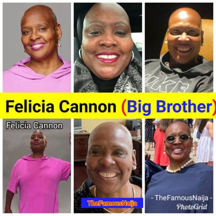 Why Is Felicia Bald On Big Brother? Alopecia Update 2023